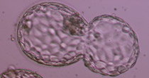 Hatching blastocyst 5AA